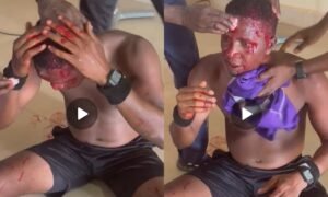 The Nationwide League One has suspended Green Beret FC for two seasons, fined the club N1.5 million and ordered it to identify the individual accused of stabbing a referee following violent scenes after a match against Zamfara United.
